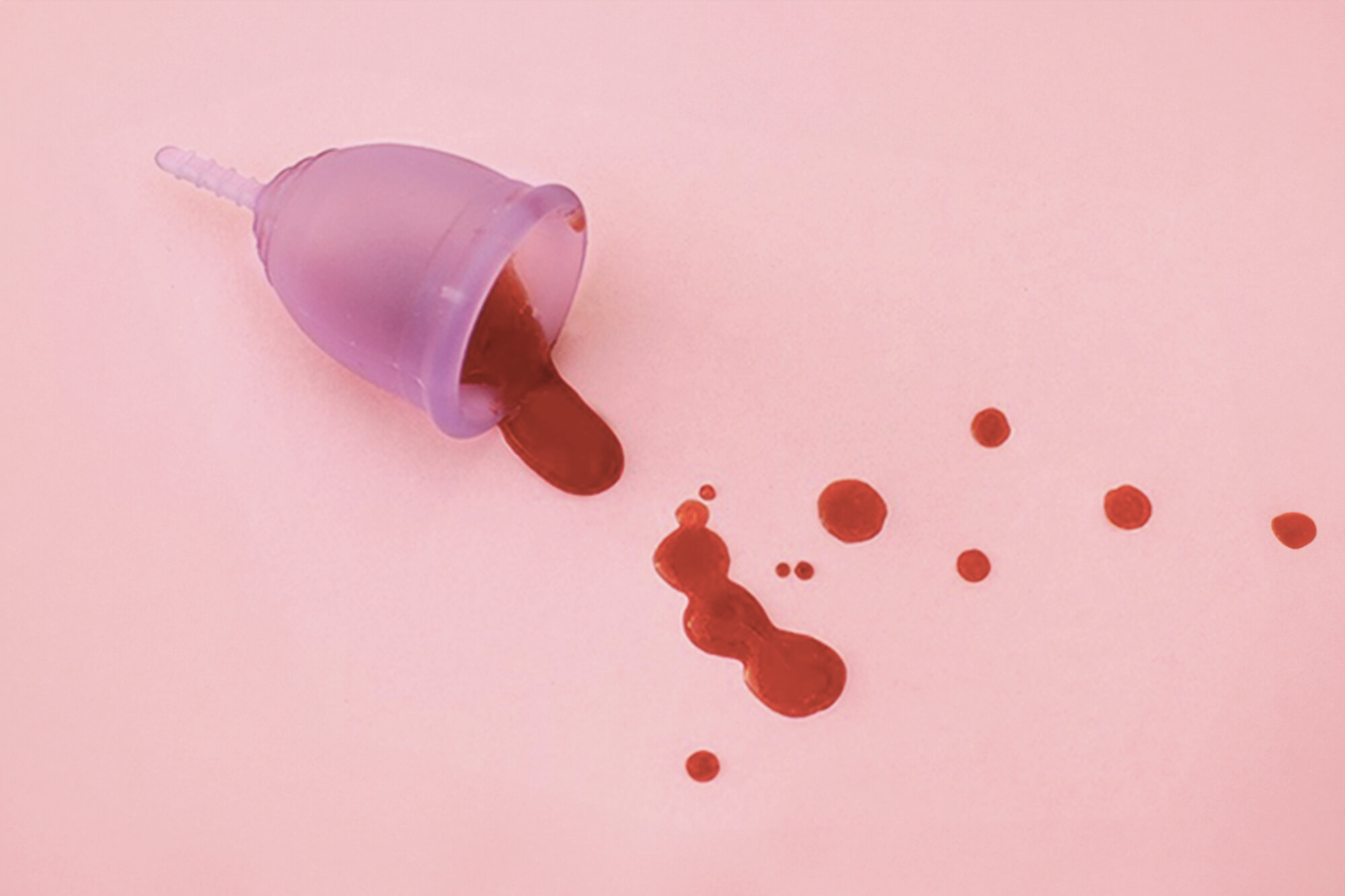 Por que o coletor menstrual vaza